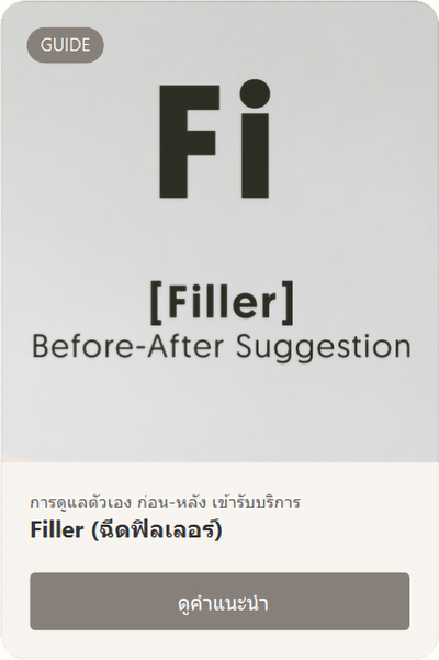 [BA] - Filler