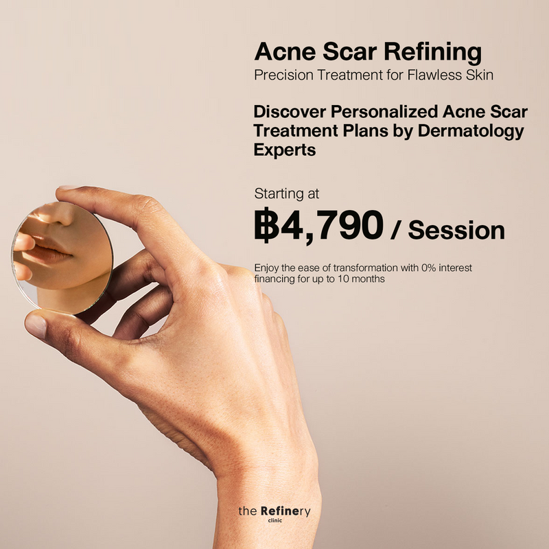 Acne Scar Refining<br><br>(โปรแกรมรักษาหลุมสิว)<br><br>