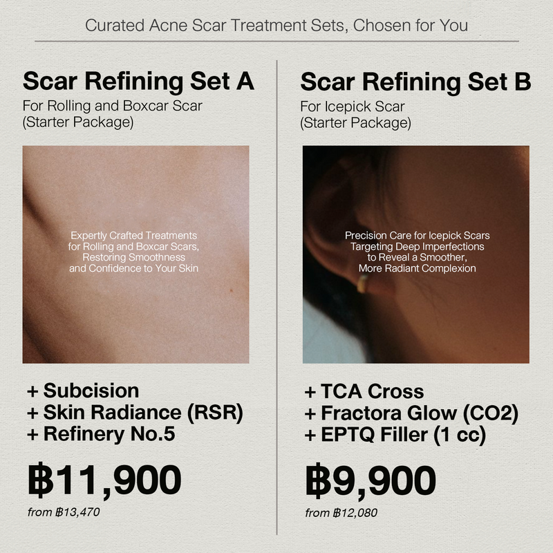 Acne Scar Refining<br><br>(โปรแกรมรักษาหลุมสิว)<br><br>