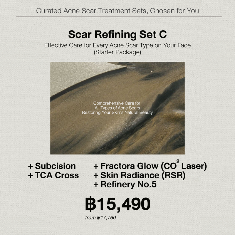 Acne Scar Refining<br><br>(โปรแกรมรักษาหลุมสิว)<br><br>