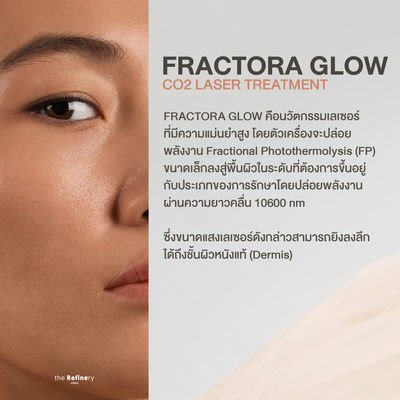 Fractora Glow<br><br>(Fractional CO2 Laser)<br><br>