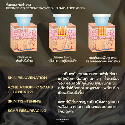 Refinery's Regenerative Skin Radiance<br><br>(ฟื้นฟูผิวด้วย Microneedle RF)<br><br>