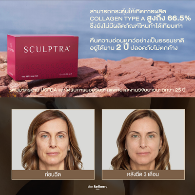 Sculptra<br><br>(ฉีดเมโสบำรุงผิวหน้า กระตุ้นคอลลาเจน ฟื้นฟูระดับโครงสร้างผิว)<br><br>