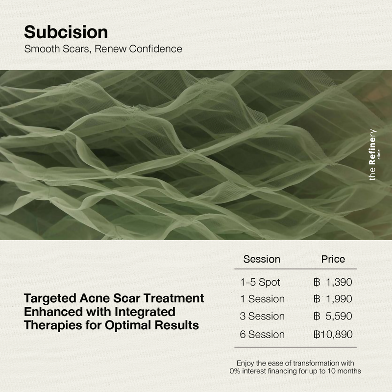 Subcision<BR><BR>(เลาะพังผืดหลุมสิว)<BR><BR>